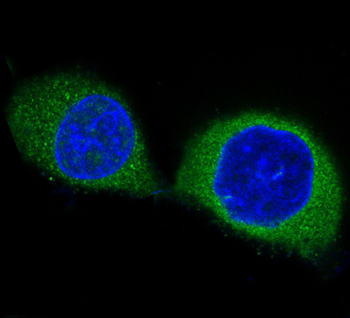 PDPK1 Rabbit mAb Antibody