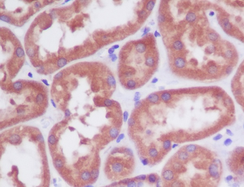 PDPK1 Rabbit mAb Antibody