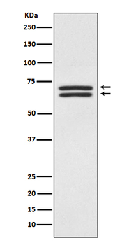 PDPK1 Rabbit mAb Antibody