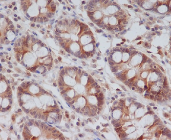 Cyclin B2 Rabbit mAb Antibody