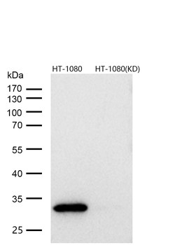 CDK4 Rabbit mAb [KD Validated] Antibody
