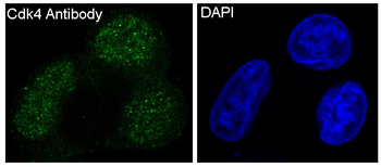 CDK4 Rabbit mAb [KD Validated] Antibody