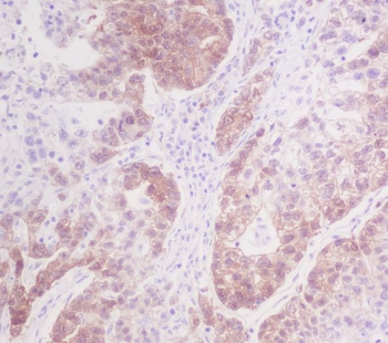 CDK4 Rabbit mAb [KD Validated] Antibody