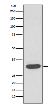 CDK4 Rabbit mAb [KD Validated] Antibody