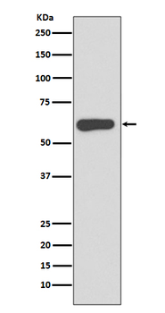 SOX10 Rabbit mAb Antibody