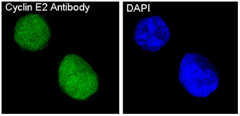 Cyclin E2 Rabbit mAb Antibody