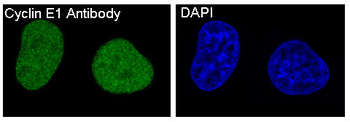 Cyclin E1 Rabbit mAb Antibody