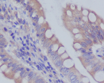 RAB7 Rabbit mAb Antibody