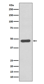 Tissue Factor Rabbit mAb Antibody