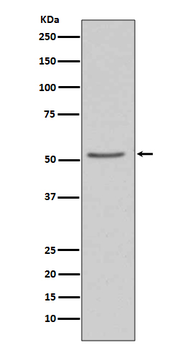 Angiotensinogen Rabbit mAb Antibody