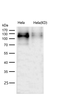 CD36 Rabbit mAb [KD Validated]