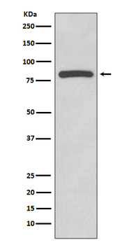 Glycogen synthase Rabbit mAb Antibody
