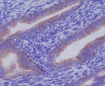 Cytokeratin 7 Rabbit mAb
