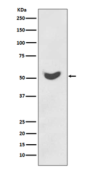 Cytokeratin 7 Rabbit mAb