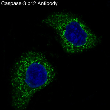 Caspase-3 p12 Rabbit mAb [KD Validated]
