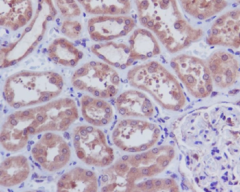 Caspase-3 p12 Rabbit mAb [KD Validated]
