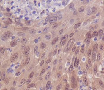IRF3 Rabbit mAb Antibody