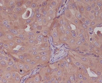 Bcl10 Rabbit mAb [KD Validated]