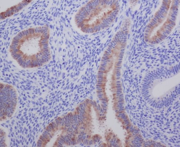 AGR2 Rabbit mAb Antibody
