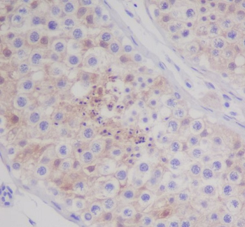 MAP1LC3A Rabbit mAb [KD Validated]