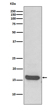 MAP1LC3A Rabbit mAb [KD Validated]