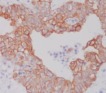 ATG5 Rabbit mAb Antibody