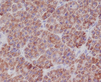 TNFAIP3 Rabbit mAb Antibody