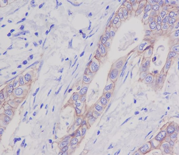 EpCAM Rabbit mAb Antibody