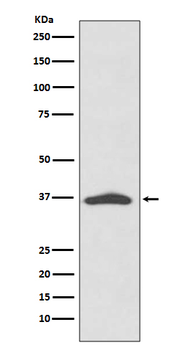 EpCAM Rabbit mAb Antibody