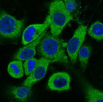 Cytokeratin 18 Rabbit mAb Antibody