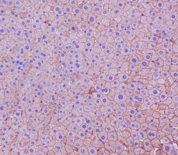 Cytokeratin 18 Rabbit mAb Antibody