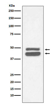Cytokeratin 18 Rabbit mAb Antibody