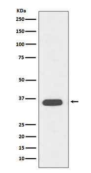 CD68 Rabbit mAb Antibody