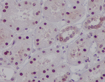 HNF-4-alpha Rabbit mAb Antibody