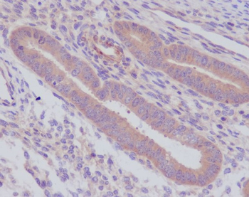 Caspase-8 Rabbit mAb