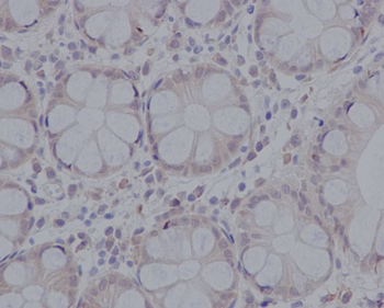 pro Caspase 3 Rabbit mAb