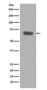 pro Caspase 10 Rabbit mAb