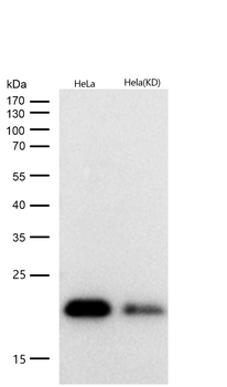 PARK7 Rabbit mAb [KD Validated]