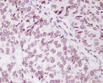 PARK7 Rabbit mAb [KD Validated]