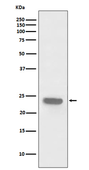 PARK7 Rabbit mAb [KD Validated]