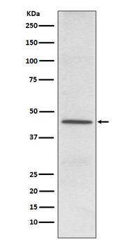 CD38 Rabbit mAb Antibody