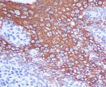 Cytokeratin 13 Rabbit mAb Antibody