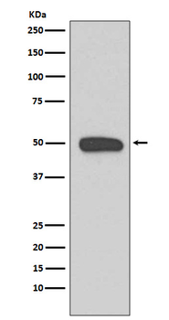 Cytokeratin 13 Rabbit mAb Antibody