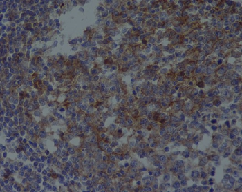 CD81 Rabbit mAb Antibody