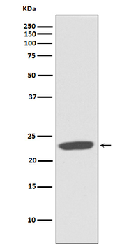 CD81 Rabbit mAb Antibody