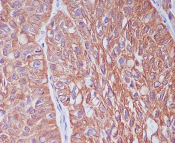 Cytokeratin 6 Rabbit mAb Antibody