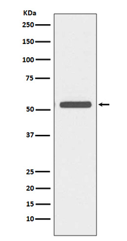 Cytokeratin 6 Rabbit mAb Antibody