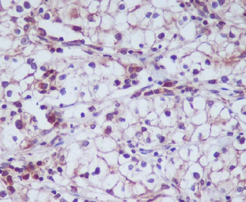 CD13 Rabbit mAb Antibody