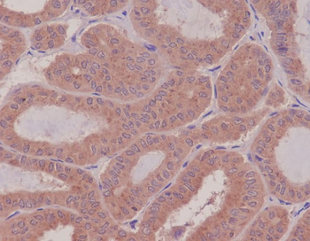 Rho Rabbit mAb Antibody