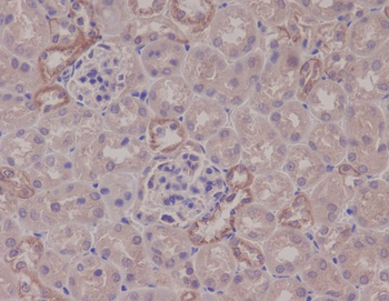 IKK alpha Rabbit mAb [KD Validated]